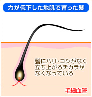 力が低下した地肌で育った髪：髪にハリ・コシがなく立ち上がるチカラがなくなっている