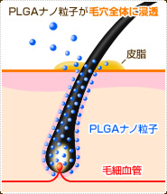 PLGAナノ粒子が毛穴全体に浸透